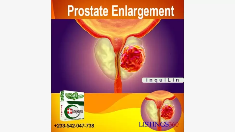 Kz50,000 Best Medicine To Cure Prostate Enlargement in Angola